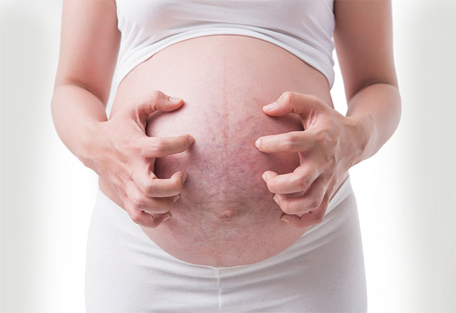 임신 중 나타나는 호르몬 대사, 면역체계, 신체의 변화는 임신부의 몸에 크고 작은 영향을 끼친다. 피부도 예외는 아니다. 살이 트거나 기미가 생기는 등의 가벼운 증상도 있지만 극심한 가려움증과 발진 등을 동반하는 경우도 적지 않다.