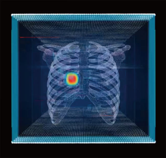 의료 스타트업 ‘뷰노’의 인공지능(AI)과 딥러닝 기술을 도입한 진단 보조 프로그램 화면. 폐 사진을 통해 의사의 코로나19 감염 여부 판단을 돕는다. 사진 뷰노
