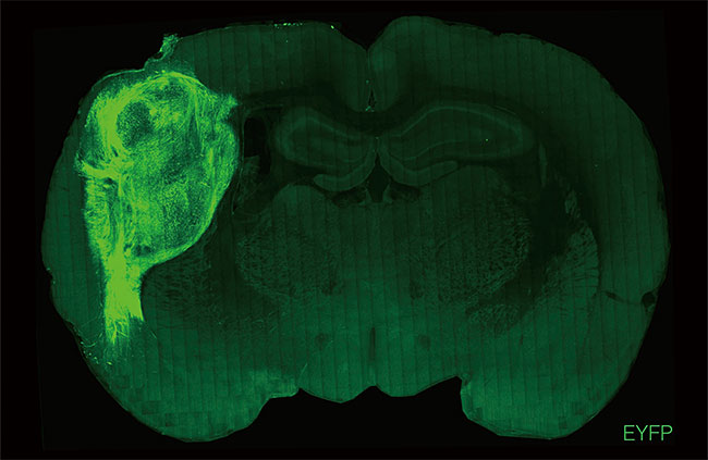 쥐의 뇌에 이식한 인간 미니 뇌가 형광 녹색으로 빛나고 있다. 미니 뇌는 쥐 뇌의 한쪽 반구에서 거의 3분의 1을 차지했다. 스탠퍼드대