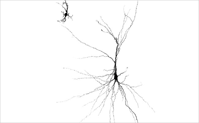 쥐의 뇌에 이식한 인간 미니 뇌의 신경세포(오른쪽)는 배양용기에서 키운 인간 신경세포(왼쪽)보다 훨씬 잘 자랐다. 스탠퍼드대