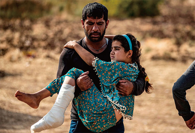 10월 22일(현지시각) 터키군이 쿠르드족 거주지역인 시리아 북부지역을 공습했다. 이 공습으로 상처 입은 한 소녀가 아버지의 팔에 안겨 이동하고 있다. 사진 AFP연합