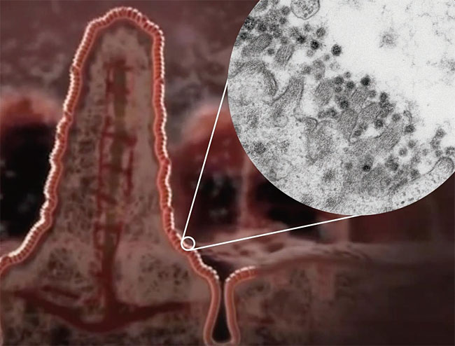 과학자들은 코로나19 바이러스가 장으로도 침투할 수 있다고 경고한다. 사진은 장에 코로나19 바이러스(검은 점)가 붙어 있는 모습. 사진 마스트리흐트대