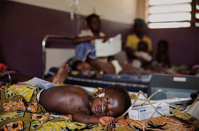 한 아동 환자가 2020년 3월 중앙아프리카공화국 보상고아 병원의 국경없는의사회 홍역 병동 집중치료실에서 치료받고 있다. 사진 국경없는의사회