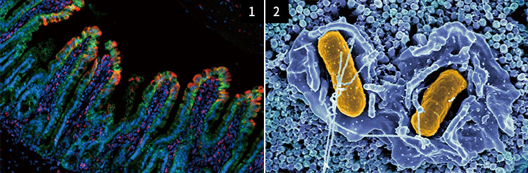 1 장에 발생한 염증으로 상피세포(녹색) 일부가 죽은 모습(붉은색). 사진 미 코넬대 의대 2 장 상피세포에 감염된 식중균인 살모넬라(노란색). 스트레스는 장에 사는 건강한
미생물을 감소시켜 다양한 질병을 유발한다. 사진 미 국립알레르기감염병연구소