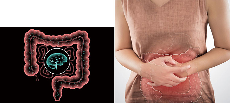 뇌와 장은 서로 연결돼 있다. 뇌가 스트레스를 받으면 장의 신경세포가 염증을 유발한다. 만성 스트레스는 장내 미생물 건강도 망가뜨려 다양한 질병을 부른다. 사진 미 하버드대 의대·게티이미지뱅크