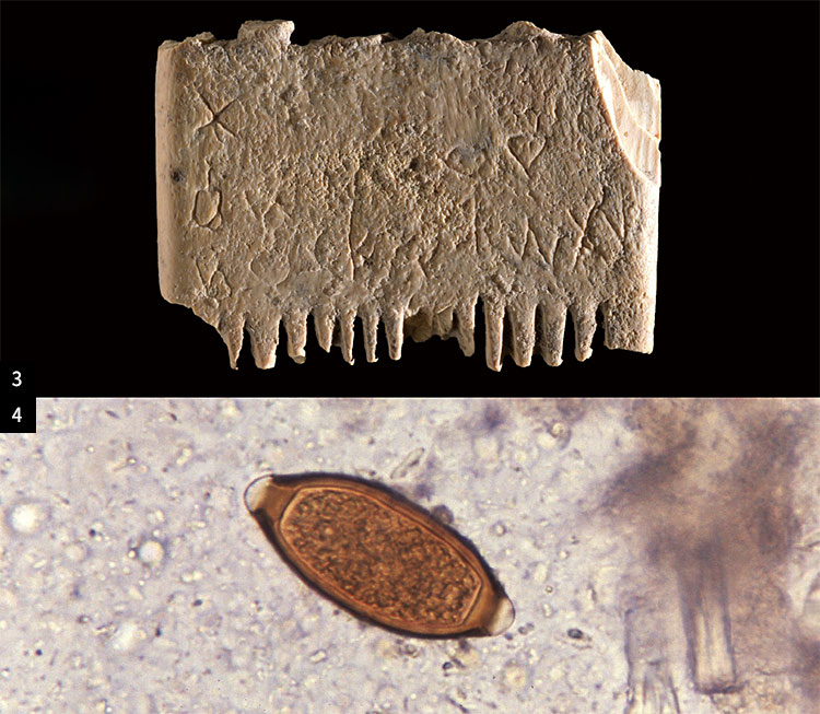 3 기원전 1700년 무렵 상아로 만든 머리빗. 당시 가나안 문자로 ‘이 상아가 머리카락과 수염의 머릿니를 박멸하길 바란다’란 뜻의 글이 새겨져 있다. 사진 이스라엘 히브리대 4 편충의 알. 바이킹 유적지에서 나온 분변 화석 속의 5000년 된 편충 알을 통해 인류의 이주 경로를 분석했다. 사진 미 질병통제예방센터