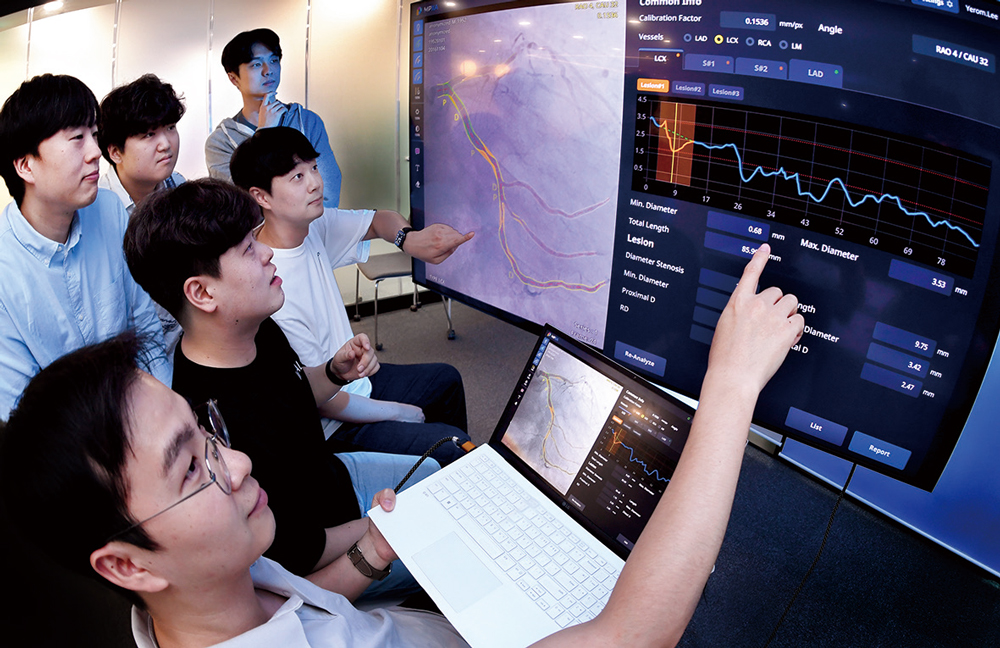 메디픽셀 임직원들이 5월 27일 서울 강남구 사무실에서 심혈관 진단 인공지능(AI) 소프트웨어 분석 결과를 보고 있다. 메디픽셀은 심혈관 조영술 영상을 2초 만에 분석하는 AI 소프트웨어를 개발했다 / 사진 조선비즈