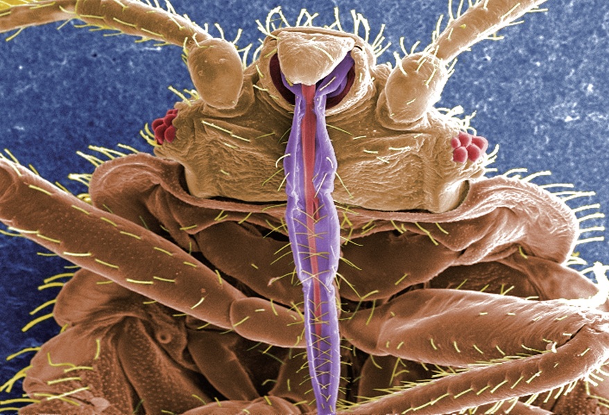 빈대(학명 Cimex lectularius)의
컬러 주사 전자 현미경(SEM) 이미지. 보라색 부분이 피를 빨기 위해 사람 피부를 관통하는 입이다. /미 질병통제예방센터