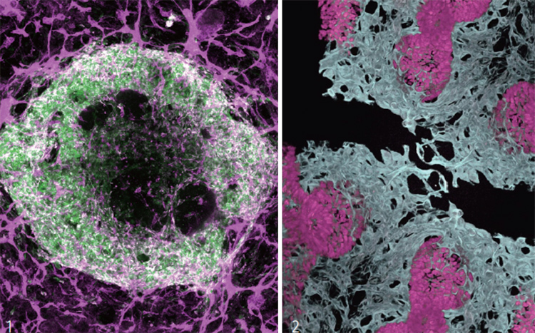 1 심근 세포(녹색)와 평활근 세포(흰색)로 구성된 2주 된 심장 오가노이드. 혈관을 만드는 내피세포(분홍색)로 둘러싸여 있다. 2 쥐 배아의 폐포 혈관(흰색)과 상피세포(분홍색). /미 스탠퍼드대·중국 베이징 줄기세포연구소