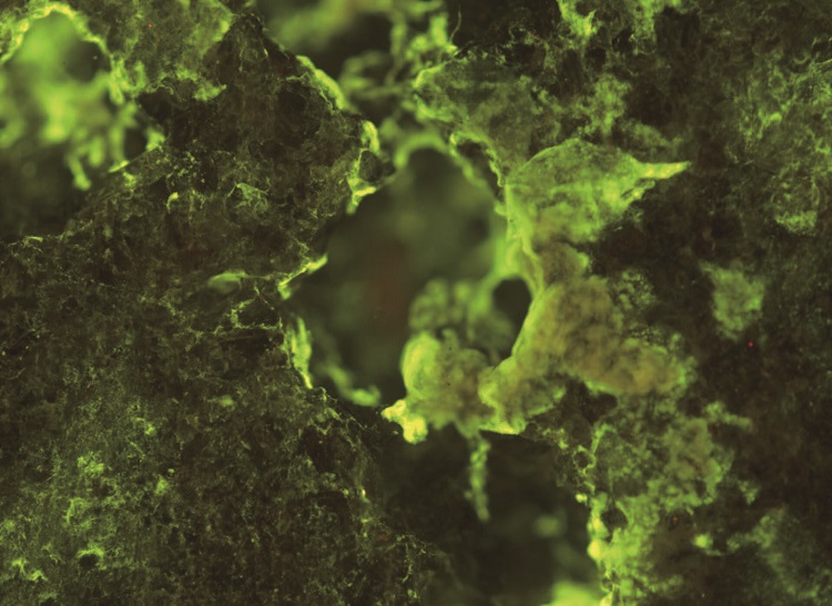 국제우주정거장에서 현무암 속 희토류 원소를 추출한
박테리아 스핑고모나스 데시카빌리스. /사진 옥스퍼드대