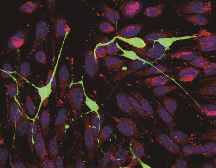 암세포(붉은색·파란색)는 신경세포(녹색)에 가는 관을 연결해 미토콘드리아를 훔치고 다른 곳으로 전이된다. /사진 사우스 앨라배마대